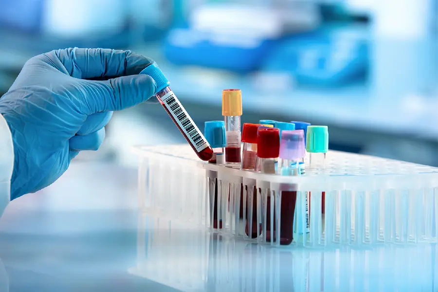 Hormone Test Tubes